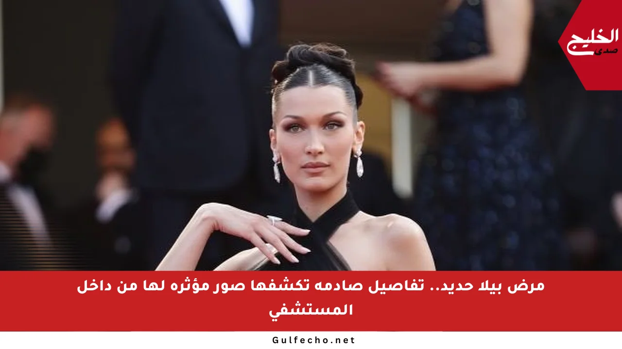 مرض بيلا حديد.. تفاصيل صادمة تكشفها صور مؤثرة لها من داخل المستشفى